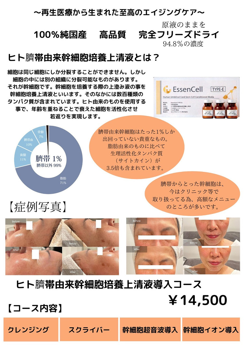 ヒト臍帯由来幹細胞上清液導入コース